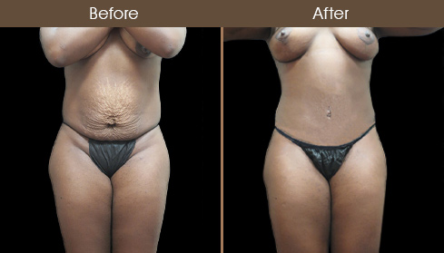 20202705190434_B50-Front